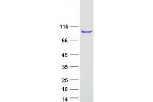 Western Blotting (WB) image for Programmed Cell Death 6 Interacting Protein (PDCD6IP) protein (Myc-DYKDDDDK Tag) (ABIN2714567)