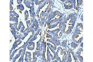 IHC analysis of ICAM1 using anti-ICAM1 antibody (ABIN7601066). (ICAM1 抗体  (AA 28-268))