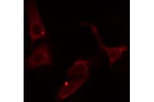ABIN6274542 staining Hela cells by IF/ICC. (SHPK 抗体  (N-Term))