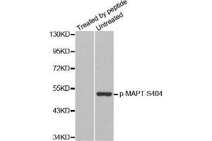 Western Blotting (WB) image for anti-Microtubule-Associated Protein tau (MAPT) (pSer404) antibody (ABIN1870403) (MAPT 抗体  (pSer404))