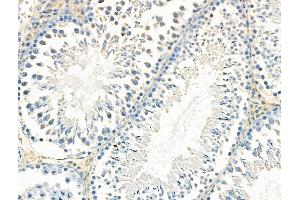 ABIN6265766 and ABIN6268647 at 1/100 staining Rat testis tissue by IHC-P.