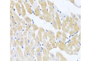 Immunohistochemistry of paraffin-embedded Rat heart using EIF2S1 Polyclonal Antibody at dilution of 1:100 (40x lens). (EIF2S1 抗体)
