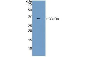 Detection of Recombinant PAI2, Rat using Polyclonal Antibody to Plasminogen Activator Inhibitor 2 (PAI2) (SERPINB2 抗体  (AA 154-408))