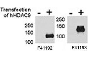 HDAC9 antibody  (HDAC9 抗体  (AA 503-533))