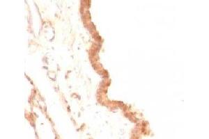 Formalin-fixed, paraffin-embedded rat lung stained with Glypican-3 antibody (GPC3/863) (Glypican 3 抗体)