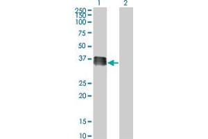 Western Blotting (WB) image for anti-SIX Homeobox 2 (SIX2) (AA 1-291) antibody (ABIN564682)