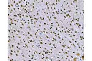 IHC analysis of SNRPN using anti-SNRPN antibody (ABIN3043934).