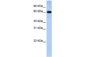 SLC22A13 antibody used at 1 ug/ml to detect target protein. (SLC22A13 抗体  (N-Term))