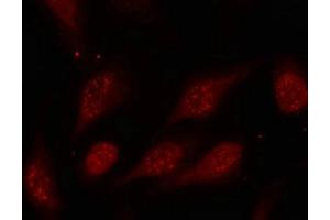 Immunofluorescence (IF) image for anti-Tumor Protein P53 (TP53) (pSer315) antibody (ABIN7138550)