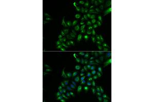 Immunofluorescence analysis of U2OS cells using TSPAN7 antibody. (Tetraspanin 7 抗体)