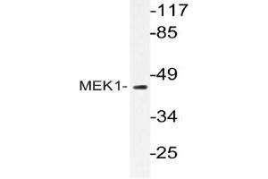 Western blot (WB) analyzes of MEK1 antibody in extracts from Jurkat cells. (MEK1 抗体)