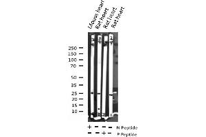 Western blot analysis of Phospho-TNNI3 (Ser43) expression in various lysates (TNNI3 抗体  (pSer44))