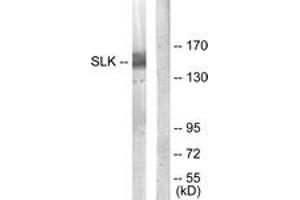 Western blot analysis of extracts from COLO205 cells, using SLK Antibody. (SLK 抗体  (AA 1151-1200))