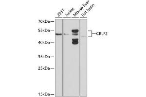 Western blot analysis of extracts of various cell lines, using CRLF2 antibody (ABIN6130231, ABIN6139052, ABIN6139053 and ABIN6214305) at 1:1000 dilution. (CRLF2 抗体  (AA 23-231))