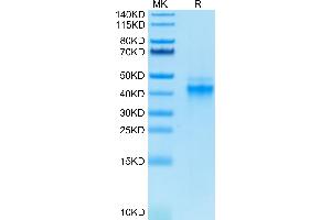 Biotinylated Human IL-12 on Tris-Bis PAGE under reduced condition. (IL12 Protein (AA 23-328) (His-Avi Tag,Biotin))
