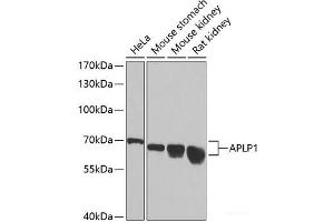Western blot analysis of extracts of various cell lines using APLP1 Polyclonal Antibody at dilution of 1:1000. (APLP1 抗体)