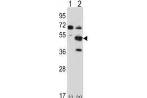 Western Blotting (WB) image for anti-PX domain-containing protein kinase-like protein (PXK) antibody (ABIN2997775) (PXK 抗体)
