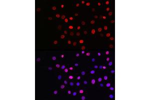 Immunofluorescence analysis of NIH/3T3 cells using Acetyl-Histone H3-K27 Rabbit mAb (ABIN3016650, ABIN3016651, ABIN3016652, ABIN1682513 and ABIN1682514) at dilution of 1:100 (40x lens). (Histone 3 抗体  (acLys27))