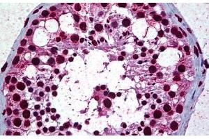 Human Testis: Formalin-Fixed, Paraffin-Embedded (FFPE) (Retinoblastoma Binding Protein 4 抗体  (AA 1-426))