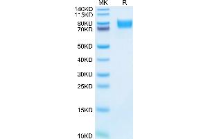 SDS-PAGE (SDS) image for Activated Leukocyte Cell Adhesion Molecule (ALCAM) (AA 28-527) protein (His tag) (ABIN7273819)