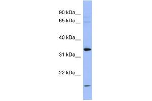 WB Suggested Anti-PYCR1 Antibody Titration: 0. (PYCR1 抗体  (Middle Region))
