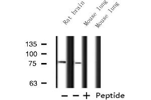 Western blot analysis of ATXN7L2 expression in various lysates (ATXN7L2 抗体  (Internal Region))