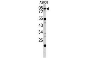 Image no. 1 for anti-Caldesmon 1 (CALD1) (Middle Region) antibody (ABIN452795) (Caldesmon 抗体  (Middle Region))