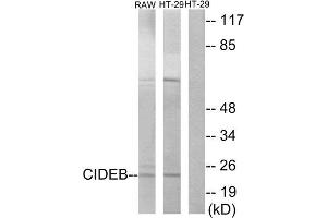 Western Blotting (WB) image for anti-Cell Death-Inducing DFFA-Like Effector B (CIDEB) (Internal Region) antibody (ABIN1850417) (CIDEB 抗体  (Internal Region))