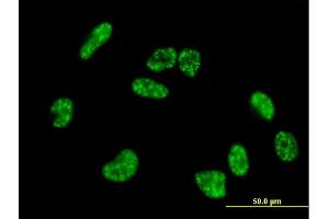 Immunofluorescence of purified MaxPab antibody to HIF3A on HeLa cell.