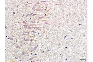 Formalin-fixed and paraffin embedded rat brain labeled with Anti-NPY/Neuropeptide Y Polyclonal Antibody, Unconjugated 1:400 followed by conjugation to the secondary antibody and DAB staining (NPY 抗体  (AA 29-64))
