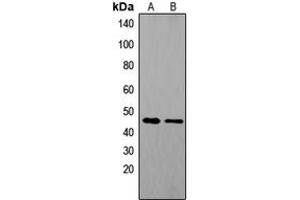 Western blot analysis of Tachykinin Receptor 1 expression in COLO205 (A), mouse brain (B) whole cell lysates.
