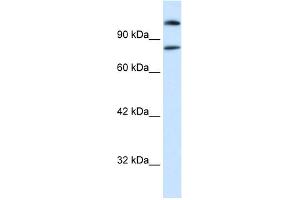 WB Suggested Anti-SREBF2 Antibody Titration:  0. (SREBF2 抗体  (Middle Region))