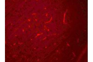 Immunofluorescence of SIK3 in rat brain cells with SIK3 antibody at 20 ug/mL. (SIK3 抗体  (C-Term))