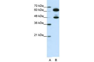 WB Suggested Anti-SNRP70 Antibody Titration:  0. (SNRNP70 抗体  (C-Term))