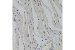 Immunohistochemistry (Paraffin-embedded Sections) (IHC (p)) image for anti-Nuclear Autoantigenic Sperm Protein (Histone-Binding) (NASP) (AA 180-449) antibody (ABIN6144374)