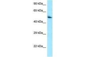 Image no. 1 for anti-Pantothenate Kinase 2 (PANK2) (AA 459-508) antibody (ABIN6748470) (PANK2 抗体  (AA 459-508))