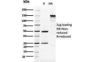 SDS-PAGE Analysis Purified Cytokeratin 5 Mouse Monoclonal Antibody (KRT5/3594). (Cytokeratin 5 抗体  (AA 316-590))
