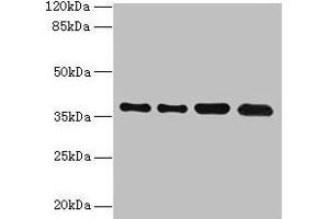 Western blot All lanes: TMEM19 antibody at 1 μg/mL Lane 1: MCF-7 whole cell lysate Lane 2: U251 whole cell lysate Lane 3: Mouse stomach tissue Lane 4: A549 whole cell lysate Secondary Goat polyclonal to rabbit IgG at 1/10000 dilution Predicted band size: 37, 33 kDa Observed band size: 37 kDa (TMEM19 抗体  (AA 105-217))