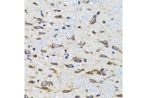 Immunohistochemistry of paraffin-embedded mouse spinal cord using CDK1 antibody. (CDK1 抗体  (AA 208-258))