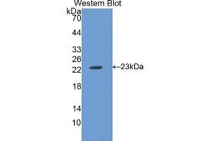 Detection of Recombinant FTH, Rat using Polyclonal Antibody to Ferritin, Heavy Polypeptide (FTH) (FTH1 抗体)