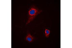 Immunofluorescent analysis of SLC43A1 staining in H9C2 cells. (SLC43A1 抗体  (Center))
