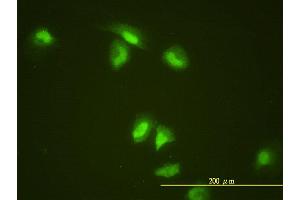 Immunofluorescence of monoclonal antibody to SLBP on HeLa cell. (SLBP 抗体  (AA 1-270))