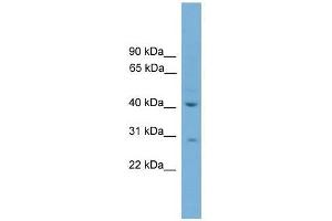HAPLN4 antibody used at 0. (HAPLN4 抗体  (C-Term))