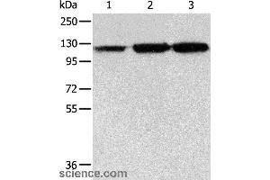 Western blot analysis of PC3 cell, human colon cancer and liver cancer tissue, using HSPH1 Polyclonal Antibody at dilution of 1:500 (HSPH1 抗体)