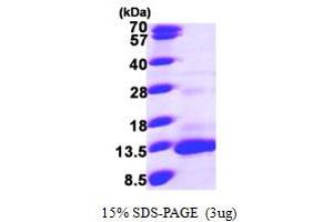 SDS-PAGE (SDS) image for Chemokine (C-C Motif) Ligand 13 (CCL13) (AA 24-98) protein (His tag) (ABIN6386599)