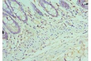 Immunohistochemistry of paraffin-embedded human colon tissue using ABIN7172504 at dilution of 1:100 (DP1 抗体  (AA 1-290))