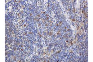 Image no. 1 for anti-Mast/stem Cell Growth Factor Receptor (KIT) (AA 546-976) antibody (ABIN1491586) (KIT 抗体  (AA 546-976))
