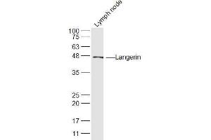Mouse Lymph node lysates probed with Langerin Polyclonal Antibody, Unconjugated  at 1:300 dilution and 4˚C overnight incubation. (CD207 抗体  (AA 161-260))