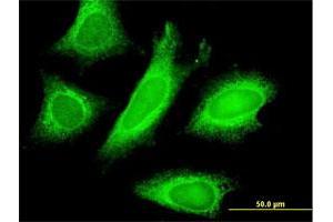 Immunofluorescence of monoclonal antibody to STAU1 on HeLa cell. (STAU1/Staufen 抗体  (AA 401-496))