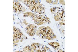 Immunohistochemistry of paraffin-embedded human stomach using CHIC2 antibody (ABIN5974773) at dilution of 1/100 (40x lens). (CHIC2 抗体)
